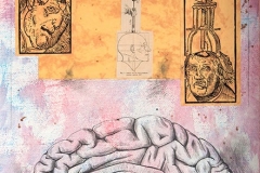 Psychosurgery - Lunacy